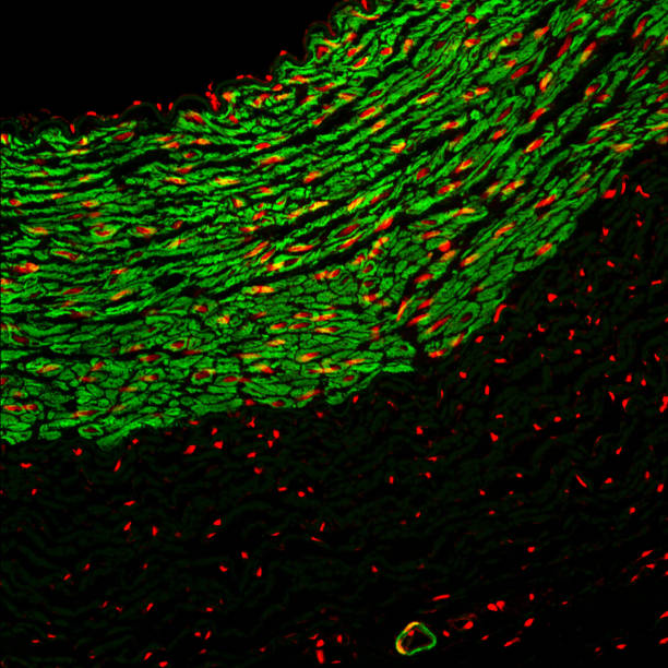 Immunofluorescence staining  endothelial stock pictures, royalty-free photos & images
