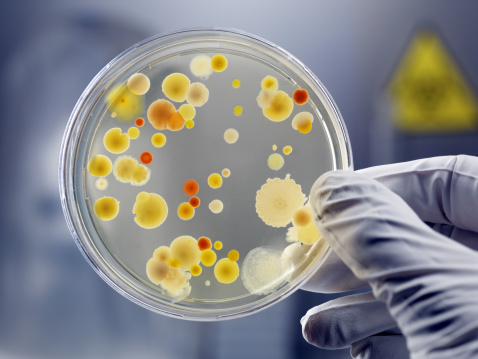 Una mano sostiene placa de Petri con Cultivo de bacterias photo