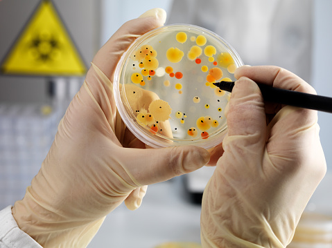 Bacteria culture on agar plate, biohazard sign in background, selective focus on the lower petri dish. AdobeRGB color profile. This and a lot of more in my lightbox medical & sciences: