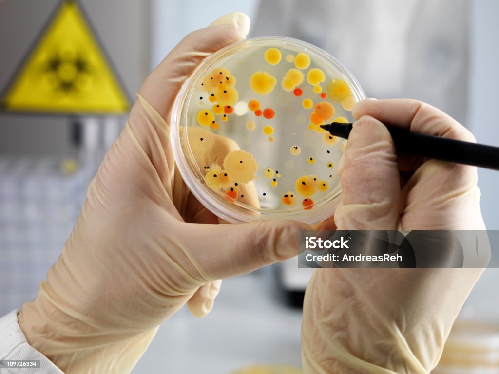 Bactéria densidade contando - Foto de stock de Gel de ágar royalty-free