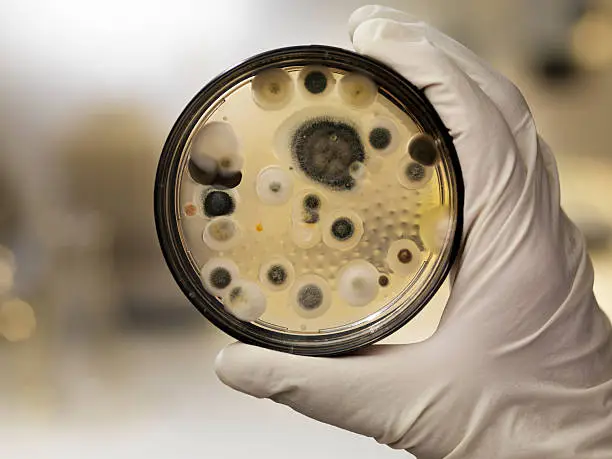 Photo of Mildew culture on agar plate, laboratory scene