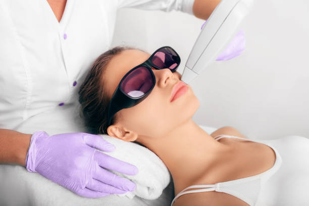 Procedure laser epilation for removing hair on face woman getting hair laser epilation, removing hair on face medical laser photos stock pictures, royalty-free photos & images