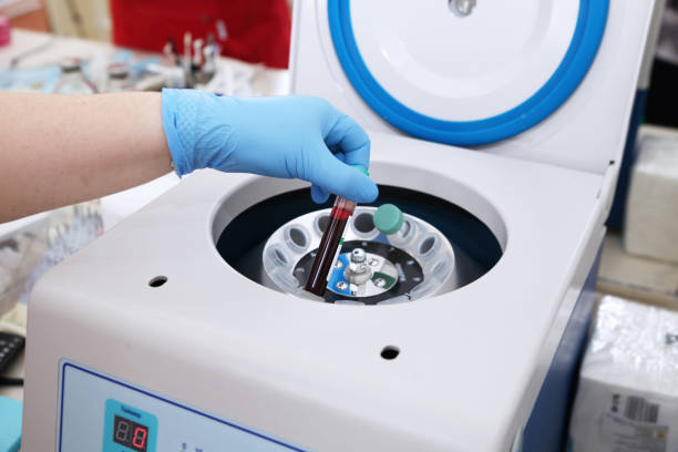 Tube of blood is placed in a medical centrifuge for plasma lifting Tube of blood is placed in a medical centrifuge for plasma lifting Medical Centrifuge stock pictures, royalty-free photos & images