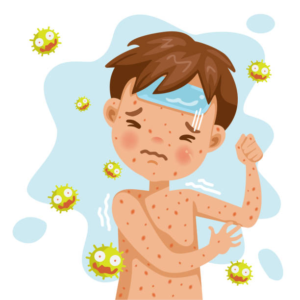 풍 진 - chickenpox skin condition baby illness stock illustrations
