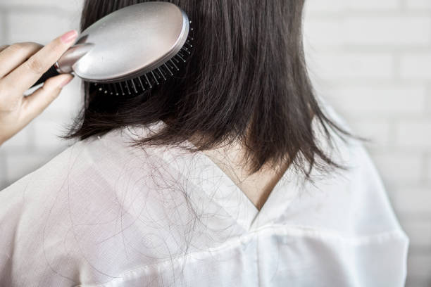 woman hair loss and falling