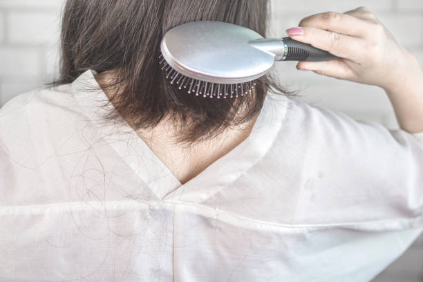 istock woman hair loss and falling 1097817018