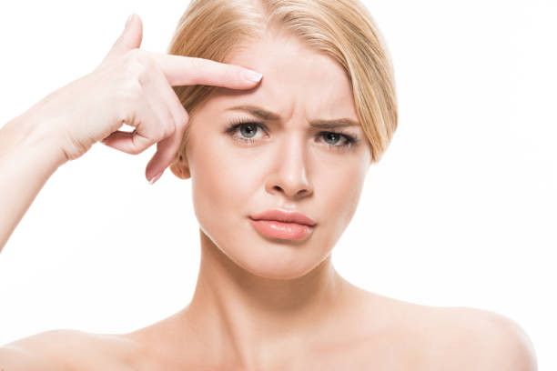 unhappy young woman pointing at wrinkles on forehead and looking at camera isolated on white stock photo