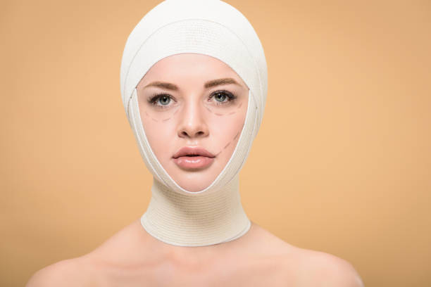 giovane donna con bende sopra la testa e segni sul viso guardando fotocamera isolata su beige - plastic surgery bandage surgery women foto e immagini stock