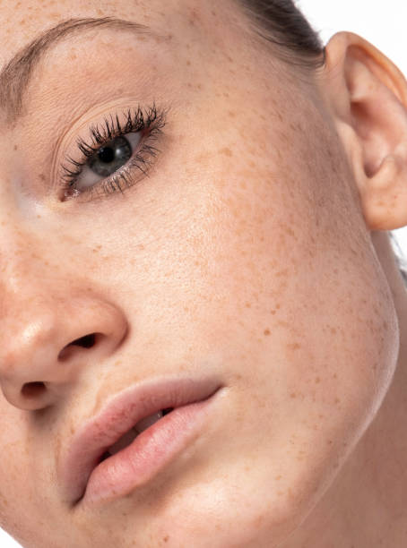 istock Beautiful young face with freckles. 1098096400