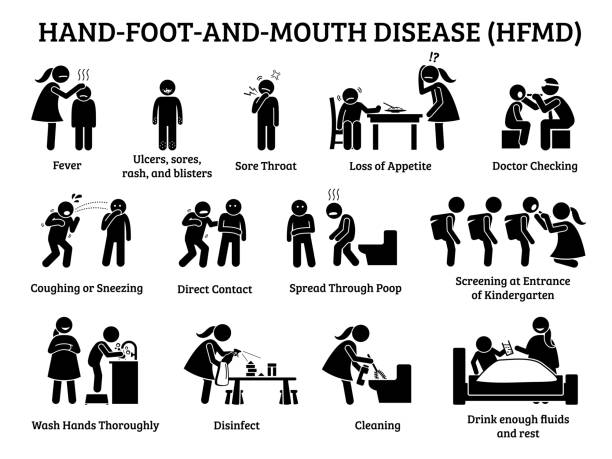 Hand foot and mouth disease HFMD icons. Illustrations depict signs, symptoms, prevention, and actions on HFMD viral infection for small children at preschool, school and daycare. hand foot and mouth disease stock illustrations