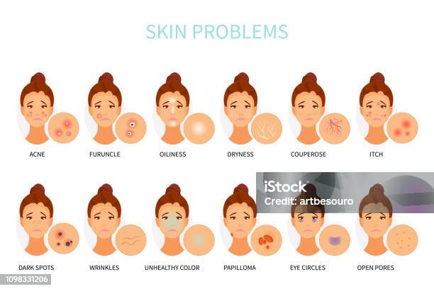 Skin Problems Animation Skin Problems Vector Stock Illustration - Download Image Now - Human ...
