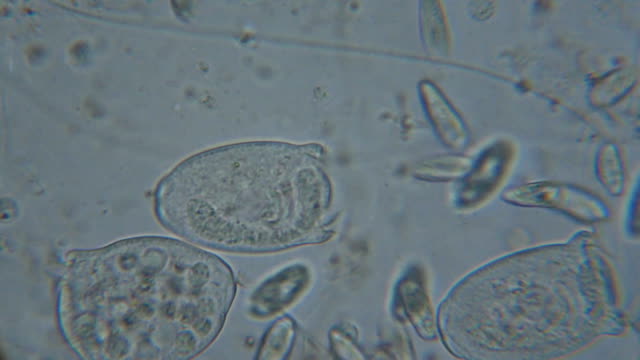 Microbes in a drop of fresh water from a lake. Vorticella (organism) in waste water under the microscope. Freshwater bell eats plankton. UHD 4K.
