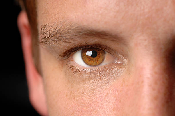 Man's Brown Eye with Cancer Close Up stock photo