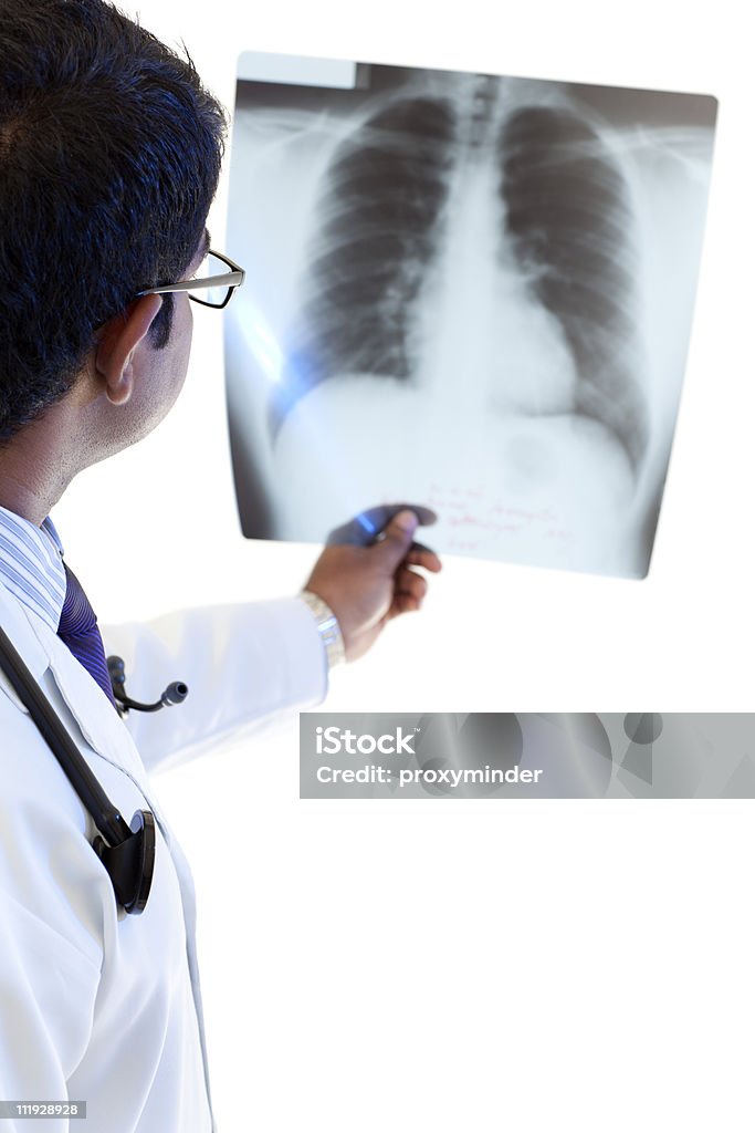 숫나사 의사가 X-레이를 폐 - 로열티 프리 X-레이 스톡 사진