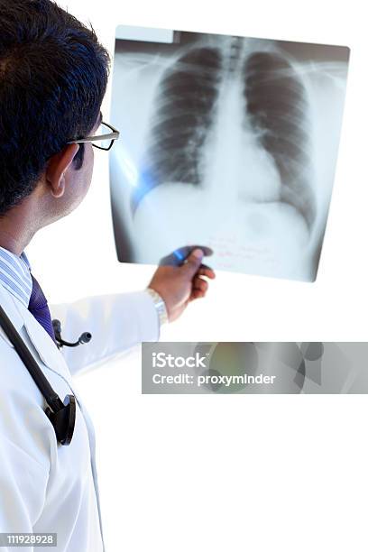 숫나사 의사가 X레이를 폐 X-레이에 대한 스톡 사진 및 기타 이미지 - X-레이, 개념, 건강 진단
