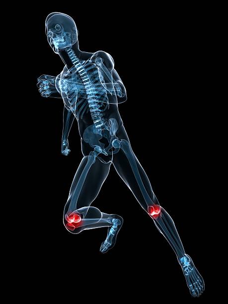bolesne kolana - x ray human knee orthopedic equipment human bone zdjęcia i obrazy z banku zdjęć