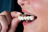 acrylic temporary teeth