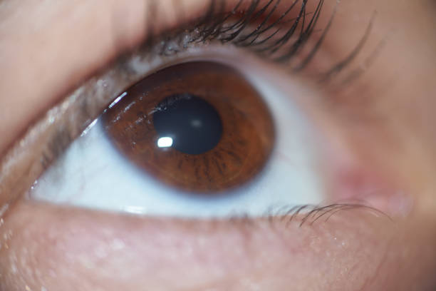 istock Macro Of Brown Woman Eye Looking Up 1124499664