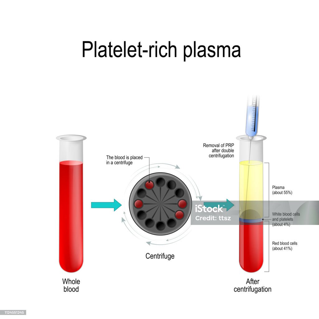 Platelet-Rich Plasma.  Blut Test Tube, Zentrifuge, Spritze und Reagenzglas mit Schichten von Blutkomponenten - Lizenzfrei Zentrifuge Vektorgrafik