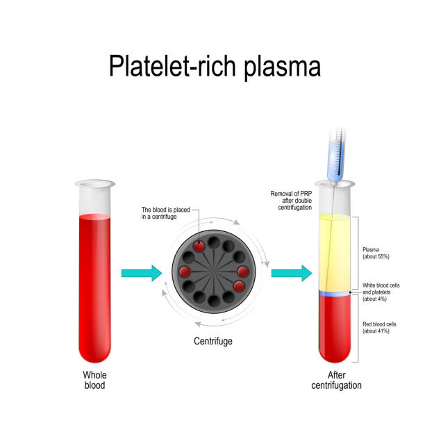 trombosit açısından zengin plazma.  kan test tüpü, santrifüj, şırınga ve tüp kan bileşenlerinin katmanlarla - santrifüj stock illustrations