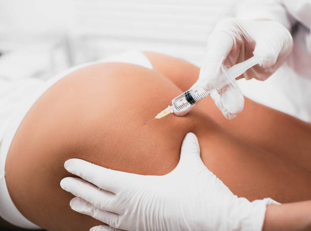 beautician doing injection into female buttocks close-up - nádega imagens e fotografias de stock