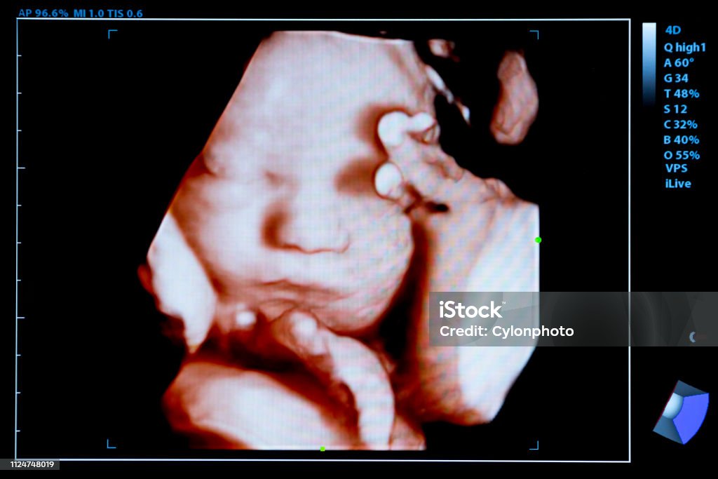Colourful image of pregnancy ultrasound monitor Colourful image of modern ultrasound monitor. Ultrasonography machine. High technology medical and healthcare equipment. Ultrasound imaging or sonography in medicine. Woman's womb during pregnancy. Ultrasound Stock Photo