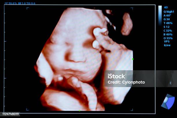 Colourful Image Of Pregnancy Ultrasound Monitor Stock Photo - Download Image Now - Ultrasound, Baby - Human Age, Fetus