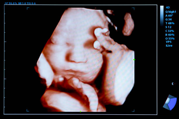 colourful image of pregnancy ultrasound monitor - ultrasound imagens e fotografias de stock