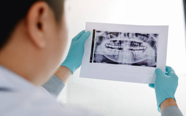 asian male dentists are analyzing x-ray images of patients at the lab. - dentist surgery dental hygiene using voice imagens e fotografias de stock