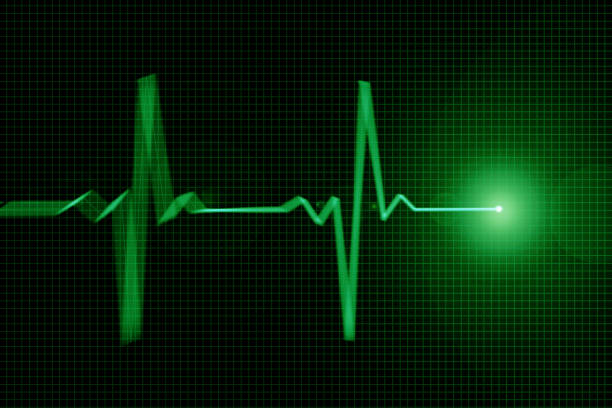 istock Green color glowing heart pulse graphic 1124994410