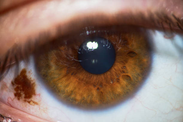 istock Rare Brown Eye With Eyeball Freckle Looking At Camera 1125030363
