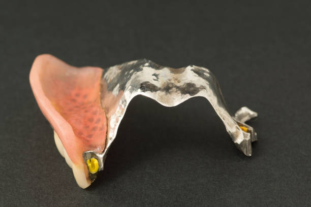 istock large image of a modern arc denture with attachmens 1125076320