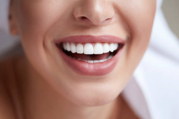 sorriso saudável branco close-up. mulher de beleza com sorriso perfeito, lábios e dentes. menina bonita do modelo com pele perfeita. clareamento dos dentes. - dentes fotos - fotografias e filmes do acervo