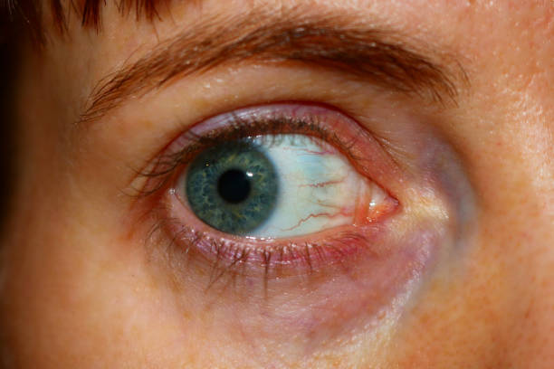 istock Woman blue eye no makeup 1125370622