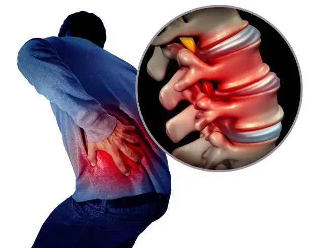 Lower back pain or backache and painful spine medical concept as a person holding the painful spinal area as a medical concept with 3D illustration elements.