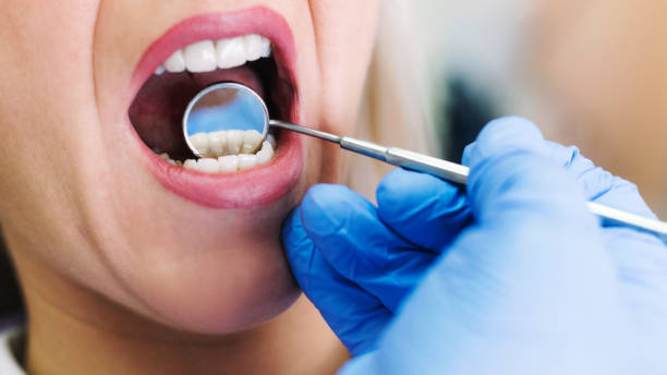 istock Woman having teeth examined at dentists 1125578153
