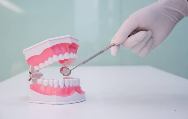 istock close up dentist hand using mirror explorer in to teeth model denture for explain correct of treatment inside oral and give information of dental knowledge to patient at clinic office , dentistry medical concept 1125621793