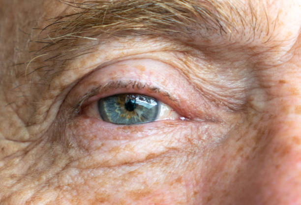 istock Right blue eye of senior Caucasian man not smiling 1125769430