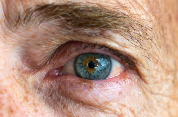 istock Left blue eye of senior Caucasian man not smiling 1125769452
