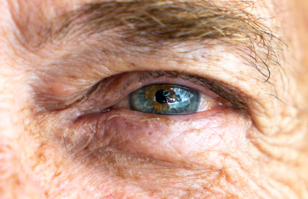 istock Left blue eye of smiling senior Caucasian man 1125781693