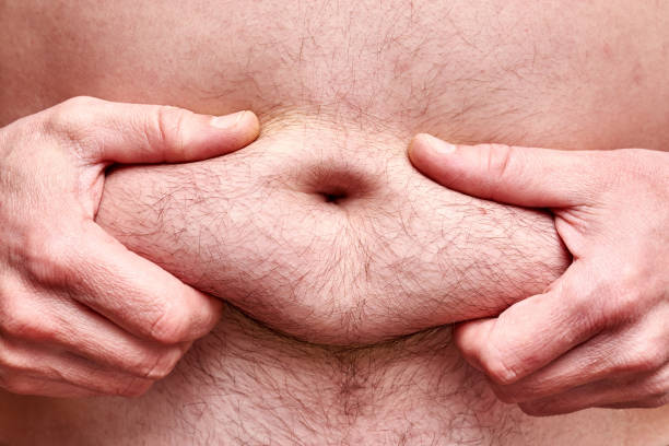 istock Male hands hold subcutaneous fat on the hairy belly. 1125783605