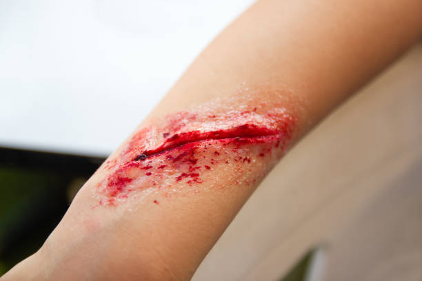 Fake wounds on the arms of children stock photo
