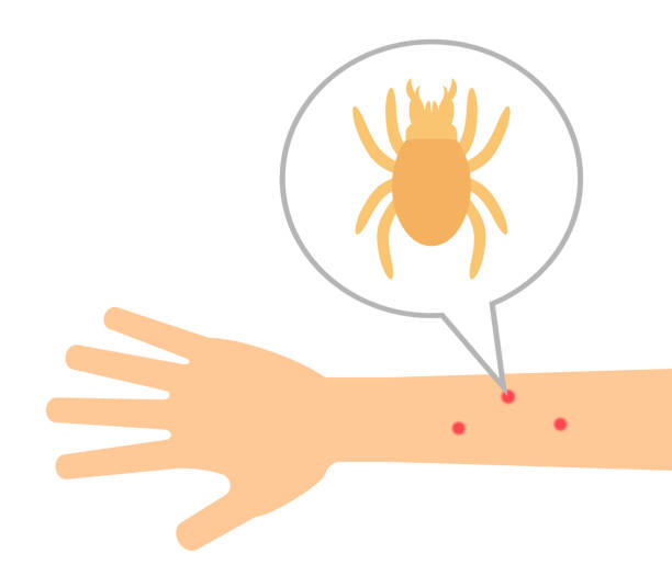 Damage of a tick The arm stuck into a tick. dani stock illustrations