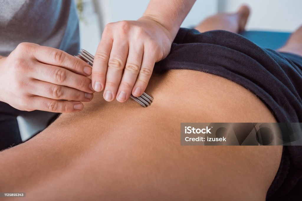 Physiotherapist massaging men's back using tools Physical therapist giving back massage to young man using tools. Close up of hands, unrecognizable people. Adult Stock Photo