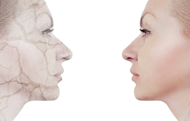 istock woman before and after the crack 1125878779