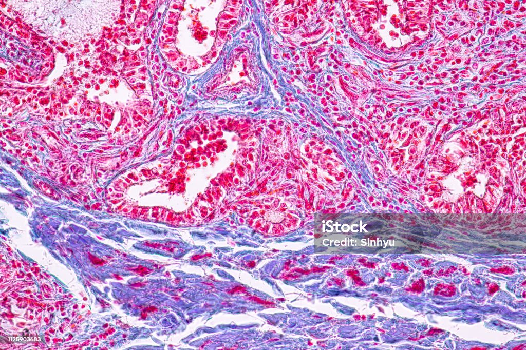 Concept of Education anatomy and physiology of mammary gland is an exocrine gland in mammals under the microscopic in laboratory. Biological Cell Stock Photo