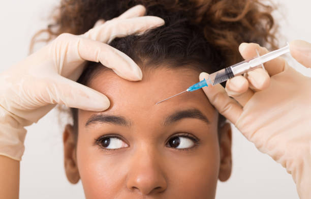 afroamerykanka dostaje zastrzyk botoksu w czoło - healthcare and medicine beauty spa botox injection hyaluronic acid zdjęcia i obrazy z banku zdjęć