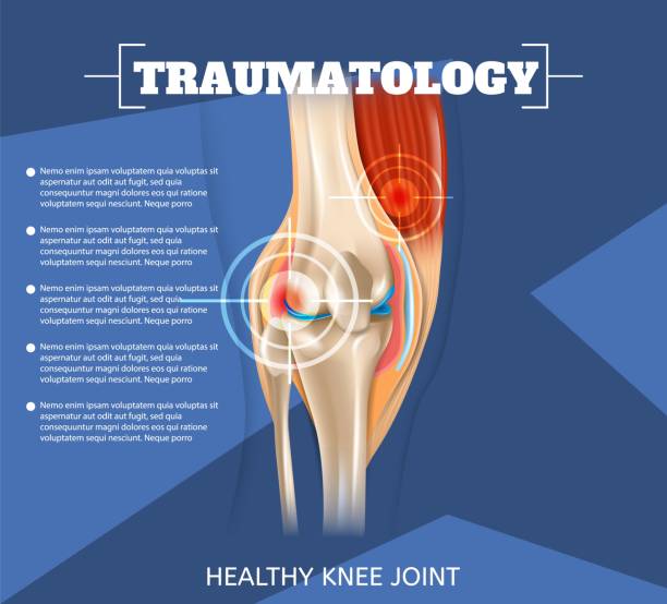 realistische darstellung traumatologie medizin in 3d - cruciate ligament stock-grafiken, -clipart, -cartoons und -symbole