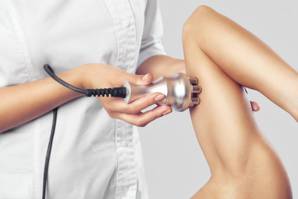 the doctor does the rf lifting procedure on the upper arm of a woman in a beauty parlor. - upper arm fotos imagens e fotografias de stock