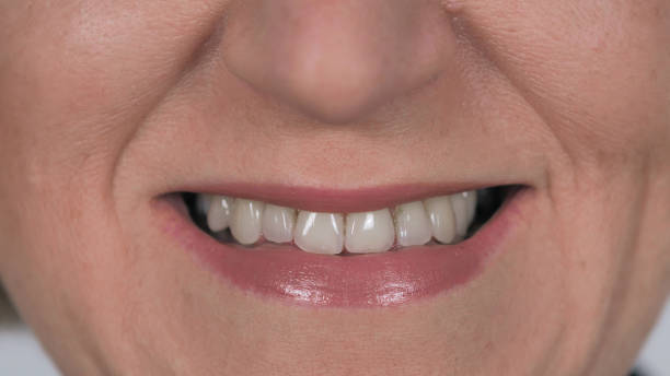 istock Close up of Old Smiling Woman with White Teeth 1126410131